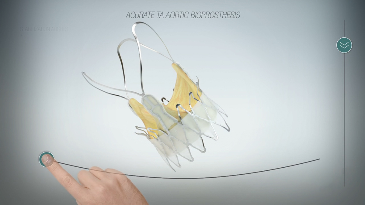 Interactive Heart Valve designed for education