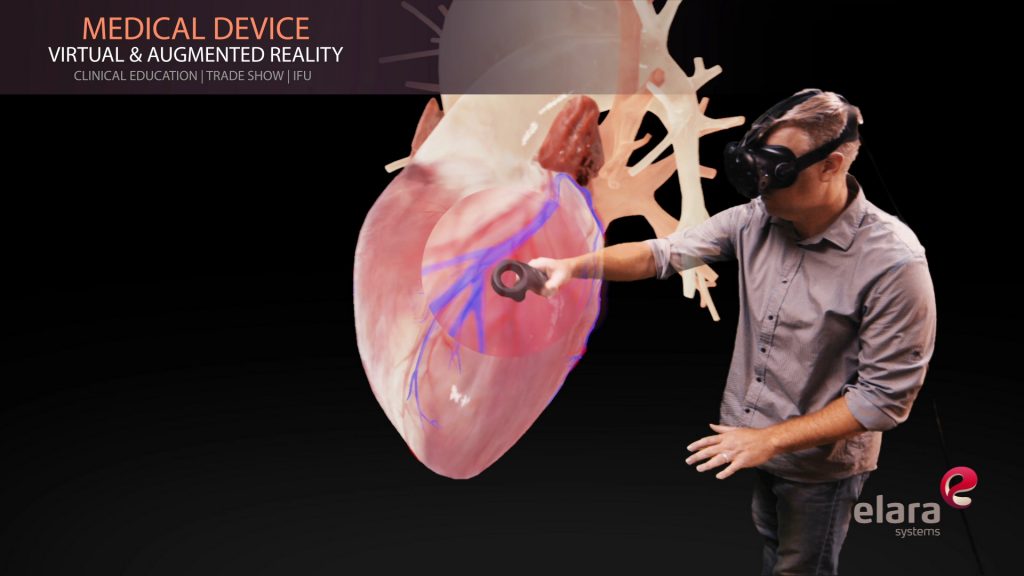 Virtual Reality for Training in the Medical Industry